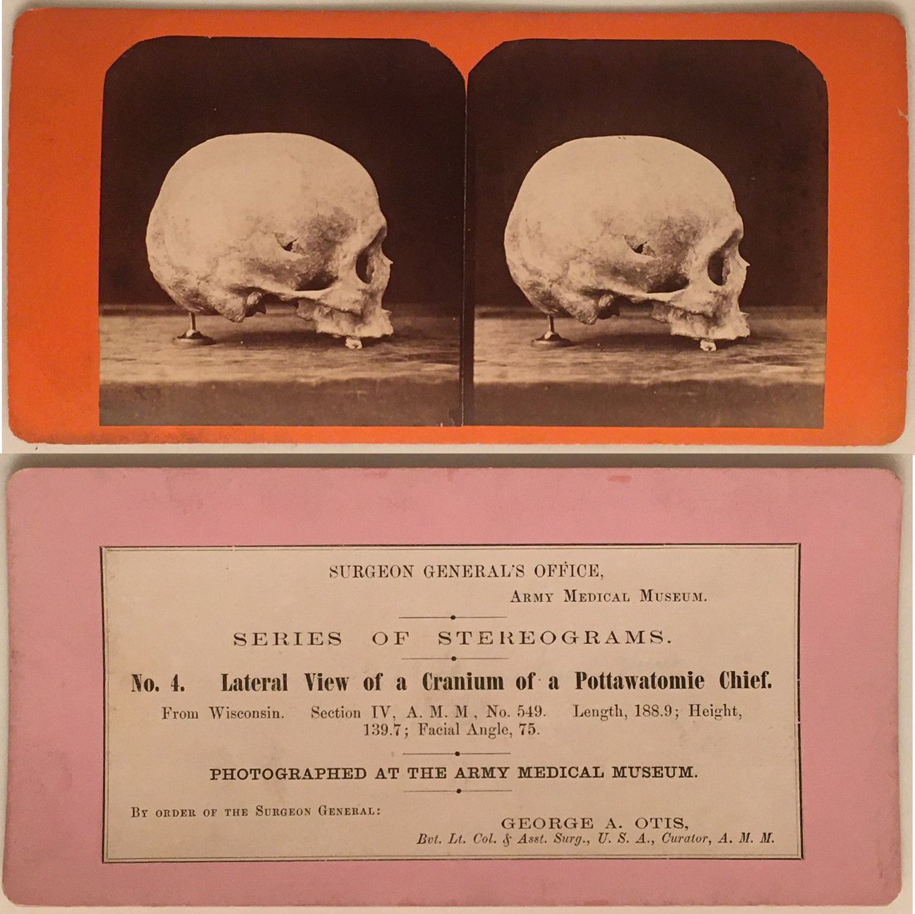 For sale: stereoview of a Potawatomi Indian skull.