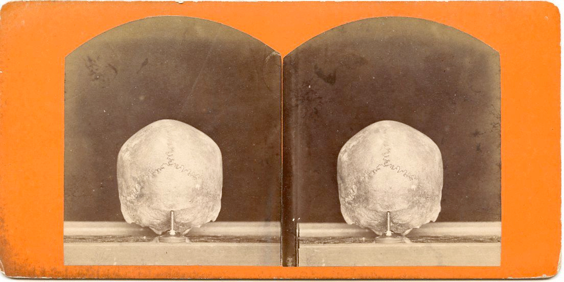 For sale: stereoview of an American
              Indian skull that was found near Fort Wadsworth, Dakota
              Territory.
