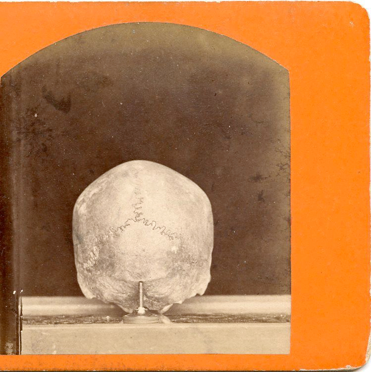 For sale: stereoview
              of an American Indian skull that was found near Fort
              Wadsworth, Dakota Territory.